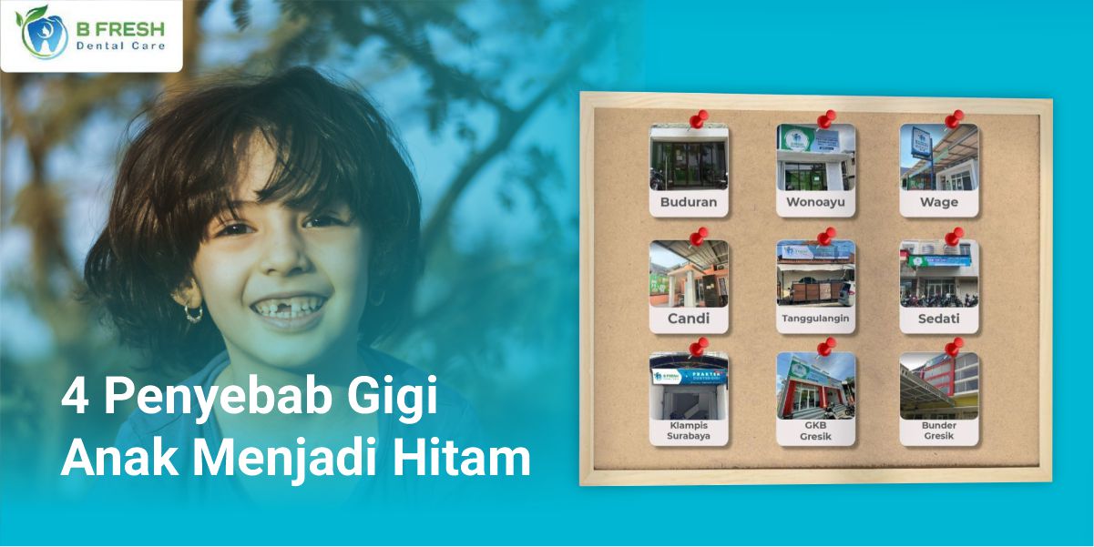 4 Penyebab Gigi Anak Menjadi Hitam