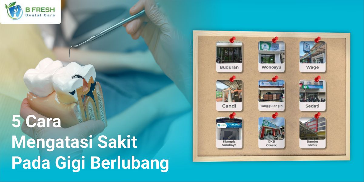 5 Cara Mengatasi Sakit Pada Gigi Berlubang