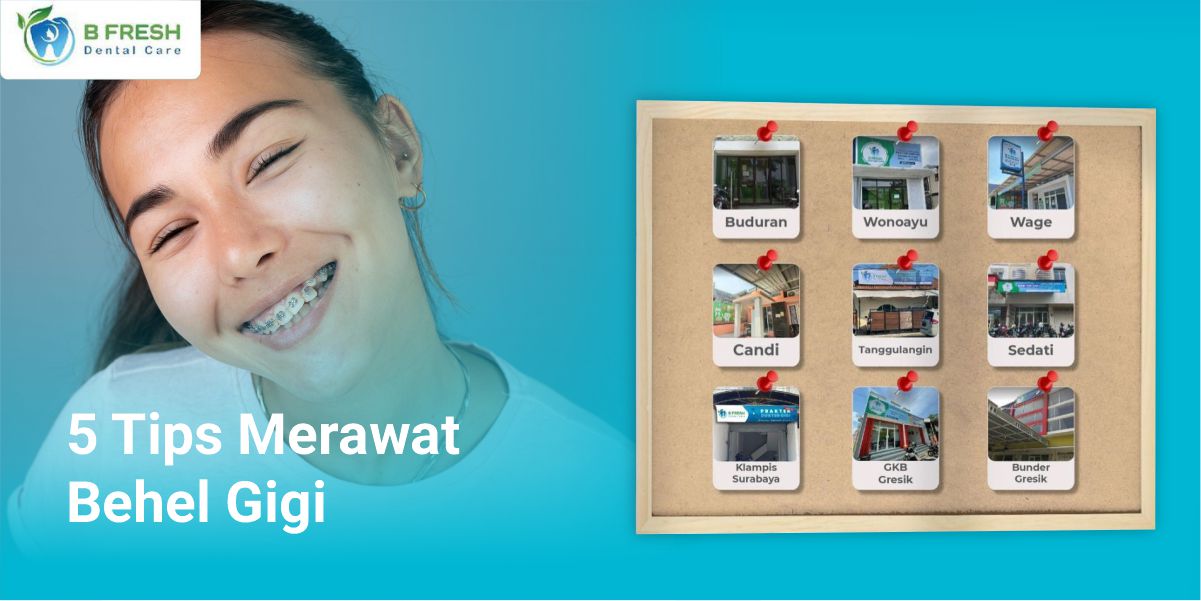 5 Tips Merawat Behel Gigi