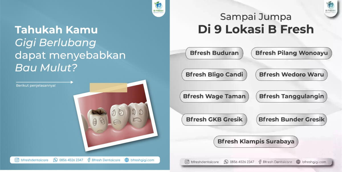 Gigi Berlubang Dapat Menyebabkan Bau Mulut