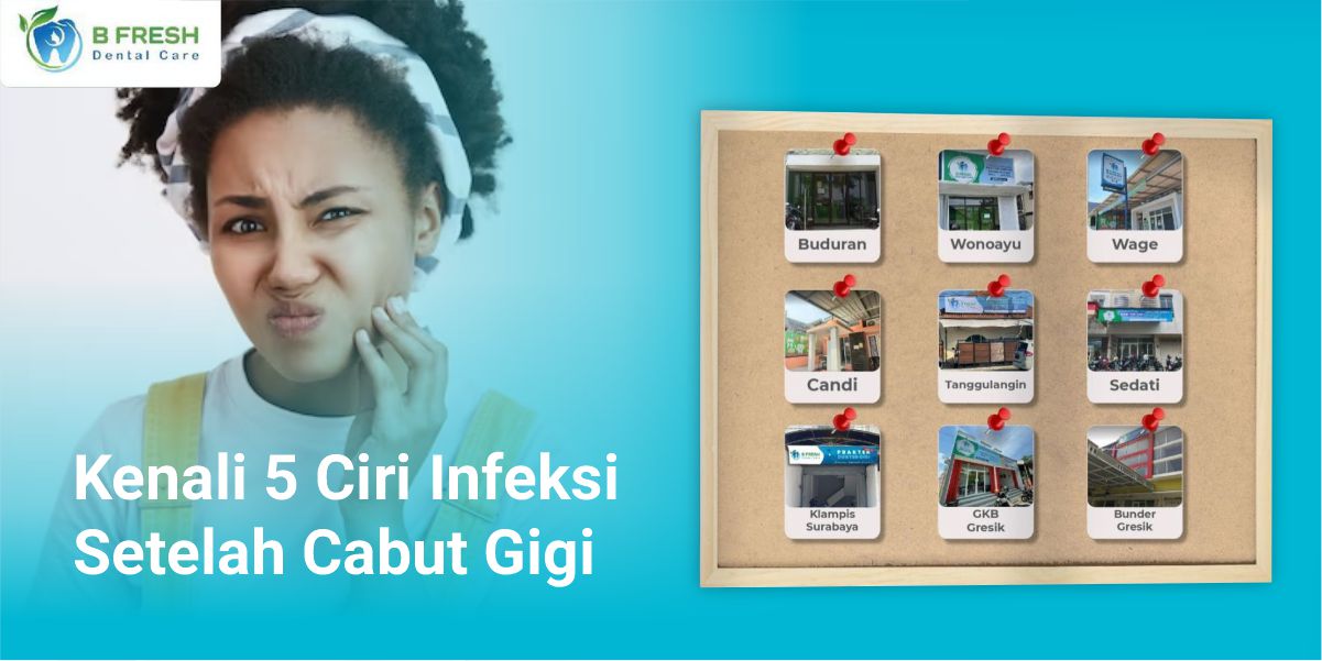 Kenali 5 Ciri Infeksi Setelah Cabut Gigi