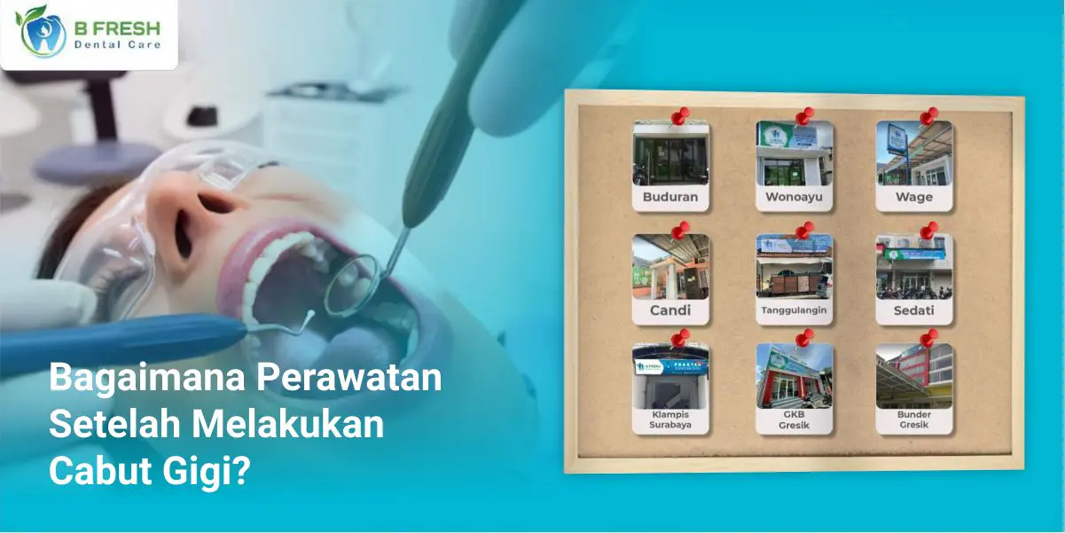 Bagaimana Perawatan Setelah Melakukan Cabut Gigi?