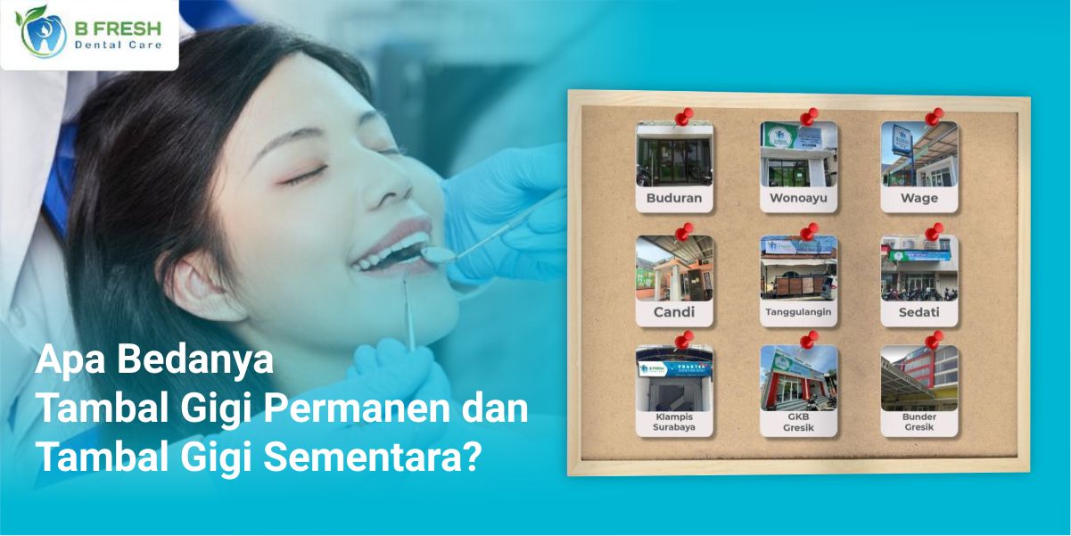 Apa Bedanya Tambal Gigi Permanen Dan Tambal Gigi Sementara?