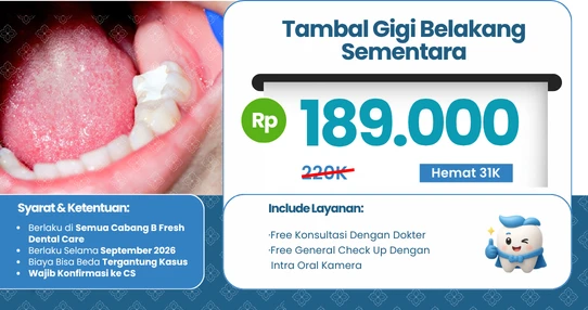 Promo Tambal Sementara